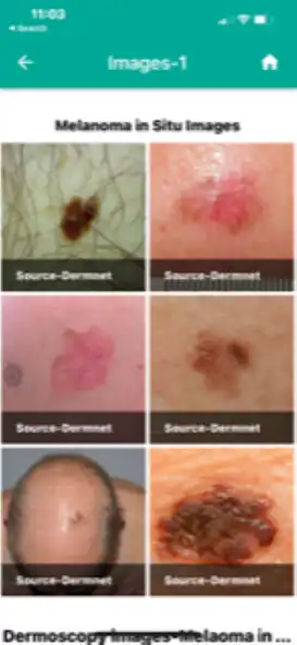 Play Skin cancer Scoring  App  and enjoy Skin cancer Scoring  App with UptoPlay