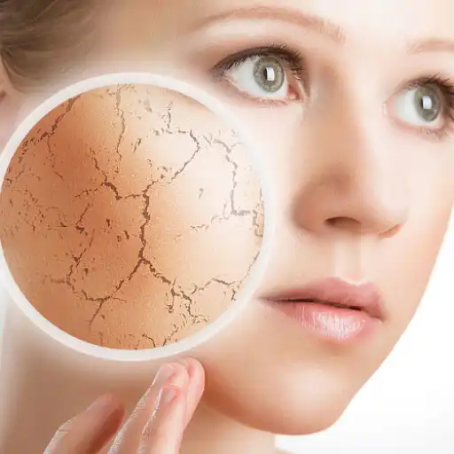 Play Skin Care Diseases  Treatment APK