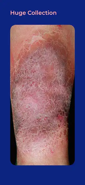 Play Skin Care Diseases Treatment and enjoy Skin Care Diseases Treatment with UptoPlay Play Skin Care Diseases Treatment and enjoy Skin Care Diseases Treatment with UptoPlay