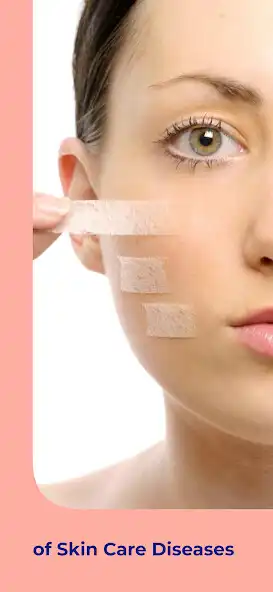 Play Skin Care Diseases Treatment as an online game online Skin Care Diseases Treatment with UptoPlay Play Skin Care Diseases Treatment as an online game Skin Care Diseases Treatment with UptoPlay