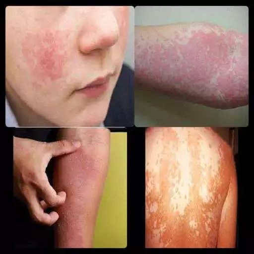 Play Skin Diseases APK Play Skin Diseases APK