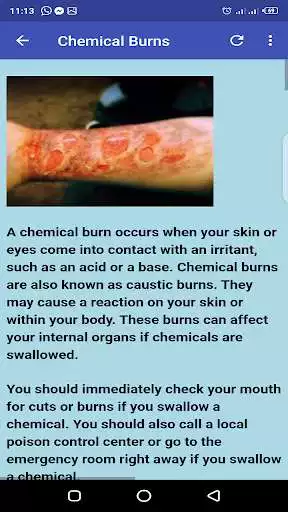 Play Skin Diseases as an online game Skin Diseases with UptoPlay