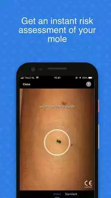 Play SkinVision