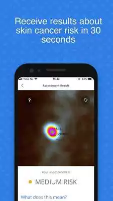 Play SkinVision