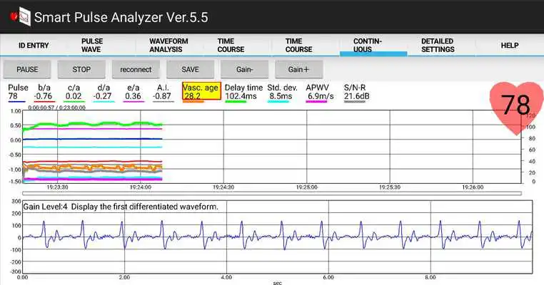 Play Smart Pulse Analyzer