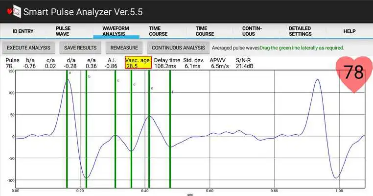 Play Smart Pulse Analyzer
