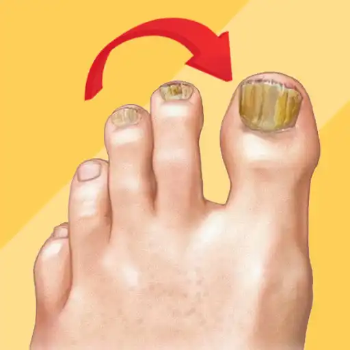 Play Solve your nail problem APK