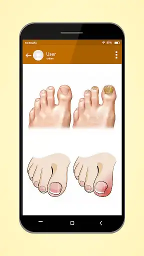 Play Solve your nail problem as an online game Solve your nail problem with UptoPlay