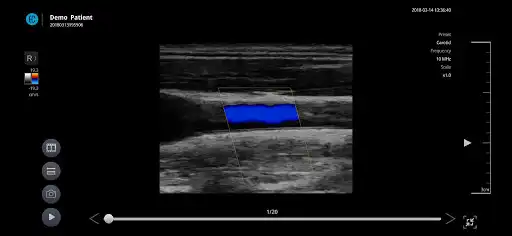 Play SONON X Ultrasound App  and enjoy SONON X Ultrasound App with UptoPlay