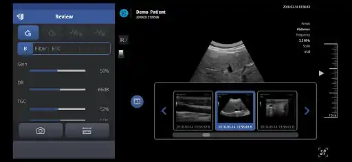 Play SONON X Ultrasound App as an online game SONON X Ultrasound App with UptoPlay