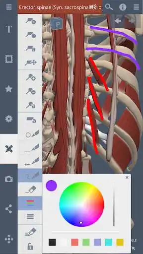 Play Spine: 3D RT - Sub