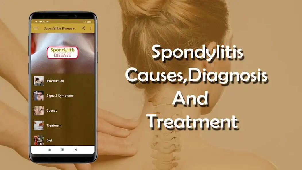 Play Spondylitis - Causes, Diagnosi  and enjoy Spondylitis - Causes, Diagnosi with UptoPlay