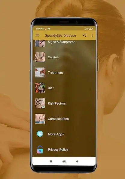 Play Spondylitis - Causes, Diagnosi as an online game Spondylitis - Causes, Diagnosi with UptoPlay