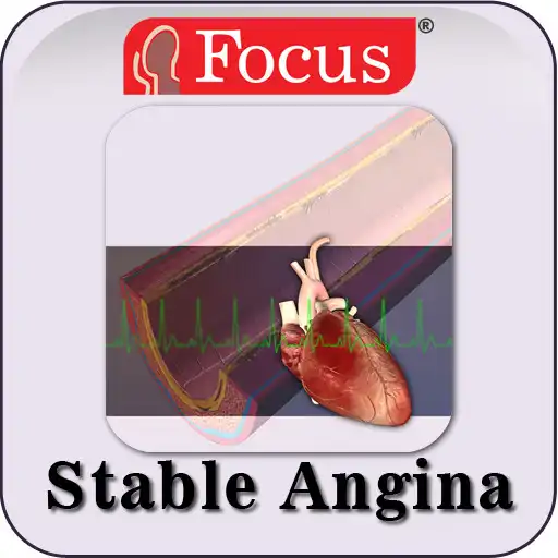 Play Stable Angina APK Play Stable Angina APK