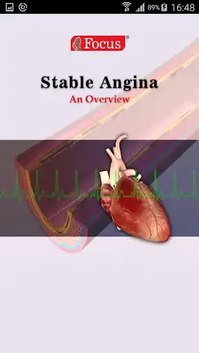 Play Stable Angina  and enjoy Stable Angina with UptoPlay