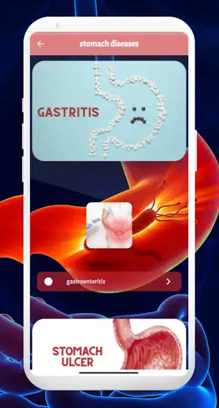 Play stomach diseases  and enjoy stomach diseases with UptoPlay