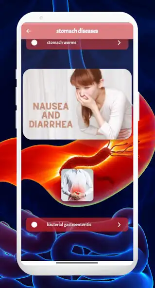 Play stomach diseases as an online game stomach diseases with UptoPlay
