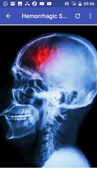 Play STROKE as an online game STROKE with UptoPlay