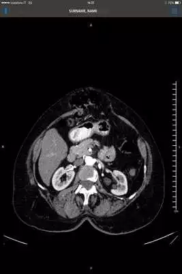 Play SUITESTENSA Mobile