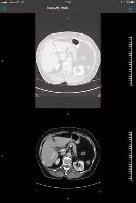 Play SUITESTENSA Mobile