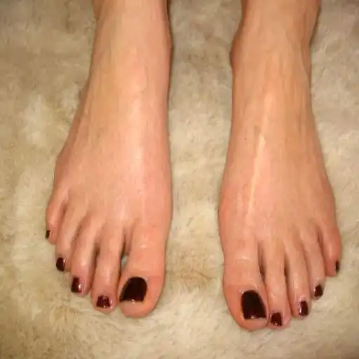 Play Sweaty Palms and Feet (Guide)  and enjoy Sweaty Palms and Feet (Guide) with UptoPlay