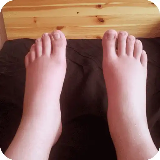 Play Swelling Feet Home Remedies APK Play Swelling Feet Home Remedies APK