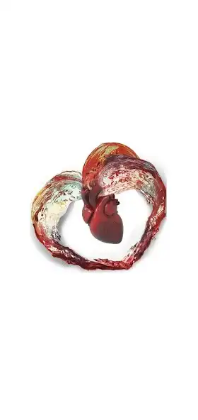 Play TAVI Sizing  and enjoy TAVI Sizing with UptoPlay