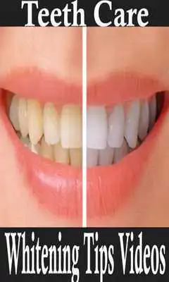 Play Teeth Care Whitening Tips Videos Play Teeth Care Whitening Tips Videos