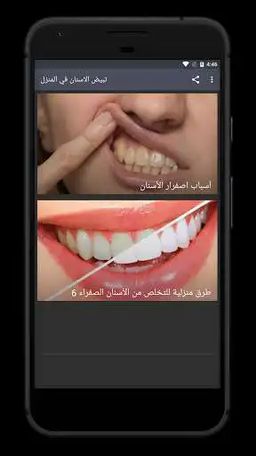Play teeth whitening at home  and enjoy teeth whitening at home with UptoPlay