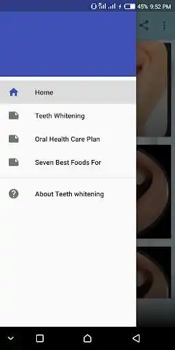 Play Teeth whitening