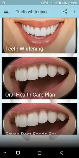 Play Teeth whitening