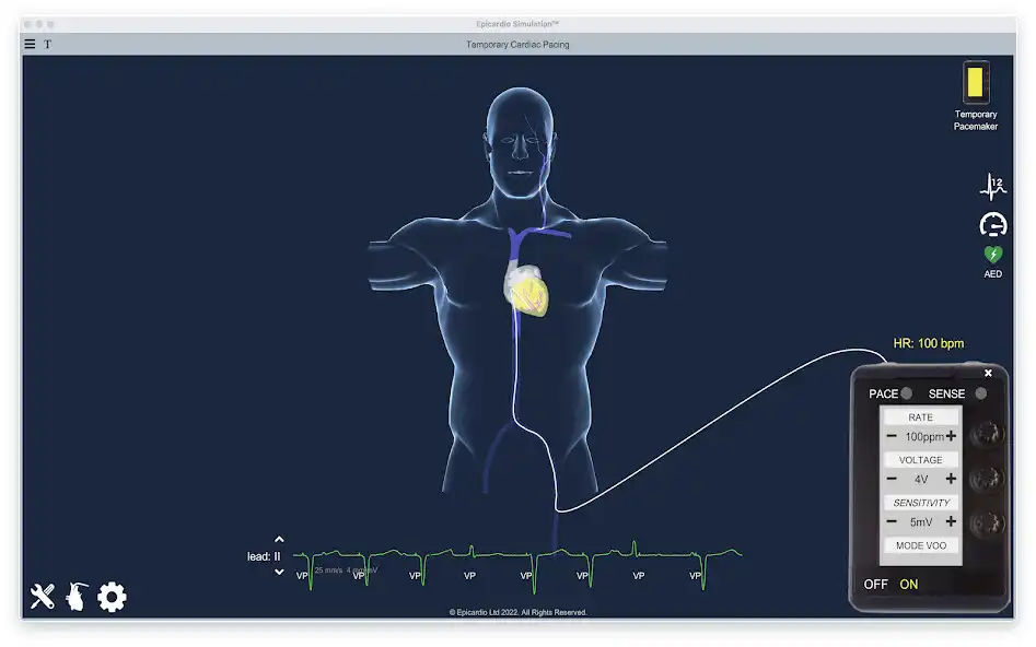 Play Temporary Cardiac Pacing  and enjoy Temporary Cardiac Pacing with UptoPlay