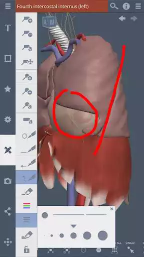 Play Thorax: 3D RT - Sub