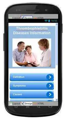 Play Thrombophlebitis Information