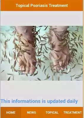 Play Topical Psoriasis treatment