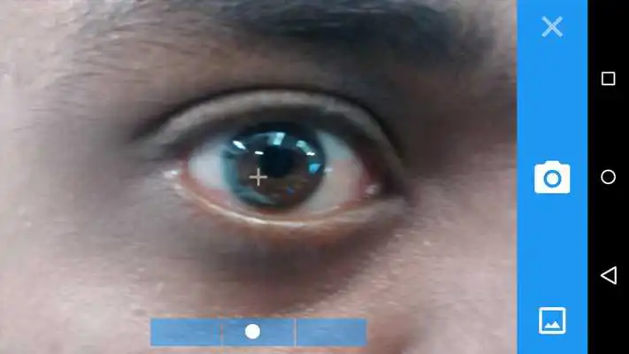 Play Toric IOL Axis Marker