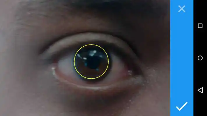 Play Toric IOL Axis Marker