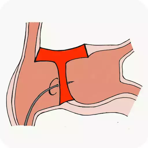 Play Transeptaid APK