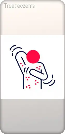 Play Treat aczema and enjoy Treat aczema with UptoPlay Play Treat aczema and enjoy Treat aczema with UptoPlay