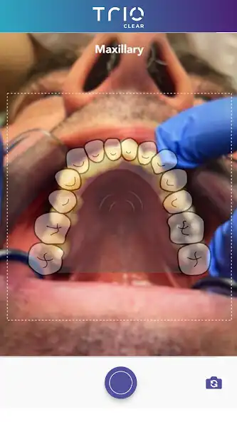 Play TrioClear Aligner as an online game TrioClear Aligner with UptoPlay