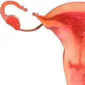 Free play online Tubectomy 3D APK