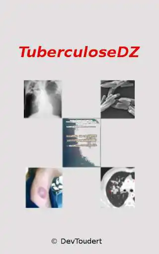 Play Tuberculose Dz  and enjoy Tuberculose Dz with UptoPlay