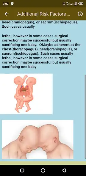Play Twins Pregnancy as an online game Twins Pregnancy with UptoPlay