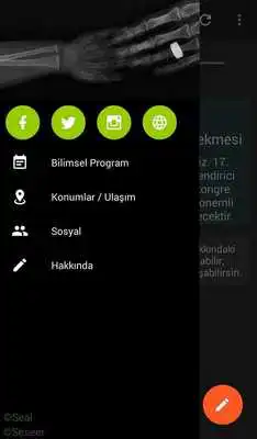 Play Ubiat Radyoloji 2016