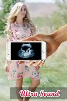 Play Ultrasound Scanner Prank