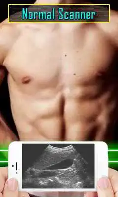Play Ultrasound Scanner Test Prank