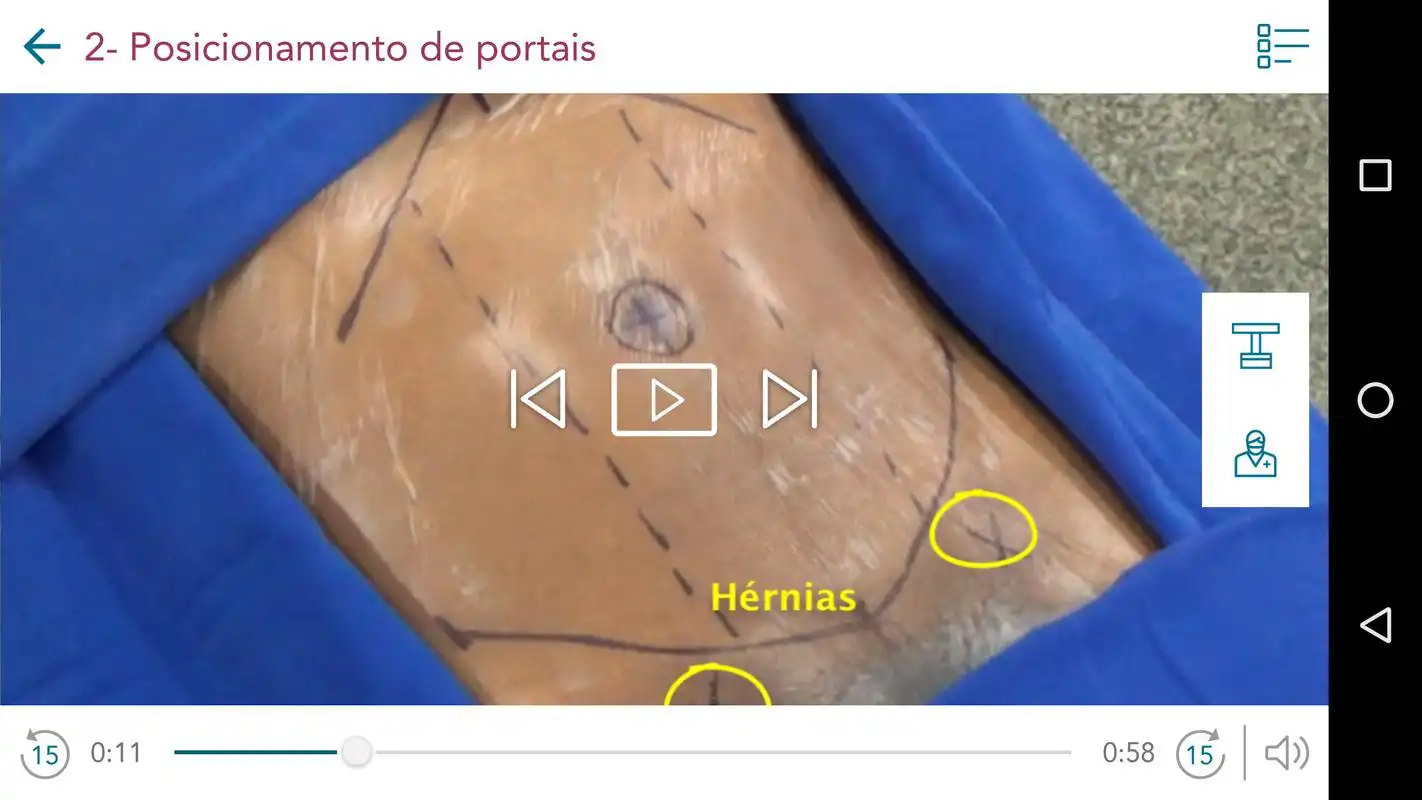 Play Videoatlas