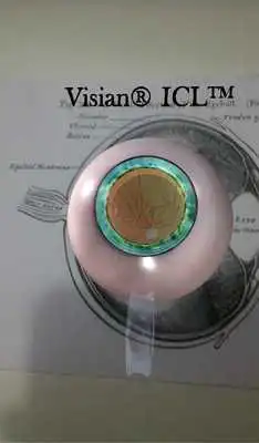 Play Visian ICL