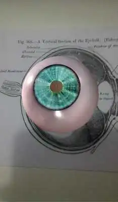 Play Visian ICL