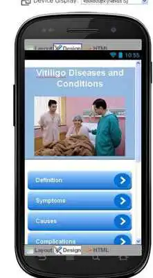Play Vitiligo Disease Symptoms Play Vitiligo Disease Symptoms